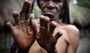 dan-tribe-cutting-fingers-